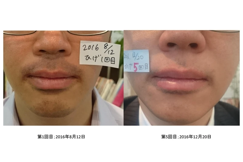 様々な薬剤の中から最適なものを選びます